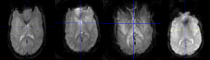 fmri_main Example of MRI images of the same subject at different locations.