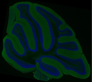 cerebellum cerebellum